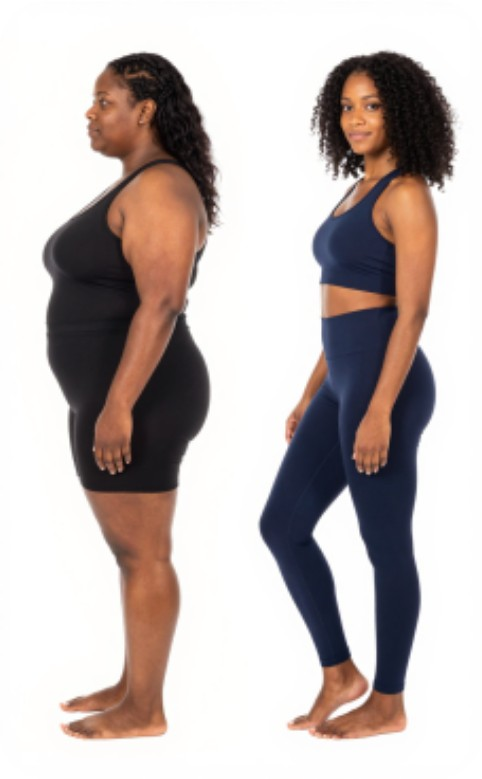 Woman shown side by side before and after her weight loss